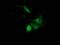 Sterol O-Acyltransferase 2 antibody, MA5-25114, Invitrogen Antibodies, Immunocytochemistry image 