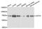 Cleavage Stimulation Factor Subunit 2 antibody, A8116, ABclonal Technology, Western Blot image 