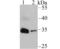 Insulin Like Growth Factor Binding Protein 2 antibody, NBP2-75535, Novus Biologicals, Western Blot image 