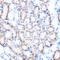 Hyaluronan Mediated Motility Receptor antibody, GTX03261, GeneTex, Immunohistochemistry paraffin image 