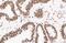Nucleoli Marker antibody, NBP2-34695B, Novus Biologicals, Immunohistochemistry paraffin image 