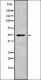 Presenilin 2 antibody, orb336852, Biorbyt, Western Blot image 