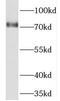 Prolyl Endopeptidase Like antibody, FNab06768, FineTest, Western Blot image 