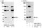 Thymidine Kinase 1 antibody, A301-280A, Bethyl Labs, Immunoprecipitation image 