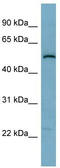 Synaptosome Associated Protein 47 antibody, TA344347, Origene, Western Blot image 