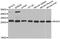 Ras Homolog Family Member H antibody, STJ28439, St John