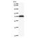 AT-Rich Interaction Domain 3A antibody, LS-C342335, Lifespan Biosciences, Western Blot image 