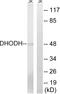 Dihydroorotate Dehydrogenase (Quinone) antibody, A30639, Boster Biological Technology, Western Blot image 