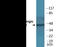 Adrenoceptor Beta 2 antibody, EKC2313, Boster Biological Technology, Western Blot image 