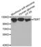 Telomerase Reverse Transcriptase antibody, abx002167, Abbexa, Western Blot image 