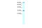 Capicua Transcriptional Repressor antibody, 27-616, ProSci, Western Blot image 