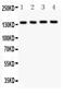 ATP Binding Cassette Subfamily B Member 4 antibody, PB9275, Boster Biological Technology, Western Blot image 