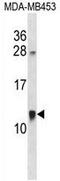 Acyl-CoA Binding Domain Containing 7 antibody, AP50041PU-N, Origene, Western Blot image 