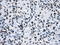 Heterogeneous Nuclear Ribonucleoprotein F antibody, GTX84356, GeneTex, Immunohistochemistry paraffin image 