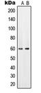 Solute Carrier Family 22 Member 6 antibody, LS-C353158, Lifespan Biosciences, Western Blot image 