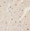 Serine/Threonine Kinase 17a antibody, FNab08326, FineTest, Immunohistochemistry paraffin image 