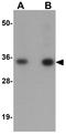 Calneuron 1 antibody, GTX31988, GeneTex, Western Blot image 