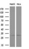 Kv channel-interacting protein 2 antibody, LS-C791213, Lifespan Biosciences, Western Blot image 