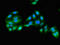 Glyoxylate And Hydroxypyruvate Reductase antibody, LS-C678140, Lifespan Biosciences, Immunofluorescence image 
