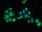 Glyoxylate reductase/hydroxypyruvate reductase antibody, LS-C678140, Lifespan Biosciences, Immunofluorescence image 