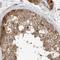 Kynurenine Aminotransferase 3 antibody, NBP1-87387, Novus Biologicals, Immunohistochemistry paraffin image 