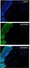 Aldehyde Dehydrogenase 3 Family Member A1 antibody, GTX112391, GeneTex, Immunohistochemistry frozen image 