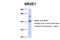 Nuclear Receptor Subfamily 2 Group E Member 1 antibody, 25-044, ProSci, Western Blot image 