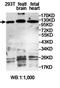 Ubiquitin Specific Peptidase 20 antibody, orb78178, Biorbyt, Western Blot image 
