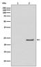 Cell Division Cycle 42 antibody, P00119, Boster Biological Technology, Western Blot image 