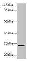 Methenyltetrahydrofolate Synthetase antibody, CSB-PA015159LA01HU, Cusabio, Western Blot image 