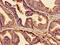 Claudin 3 antibody, LS-C671398, Lifespan Biosciences, Immunohistochemistry paraffin image 