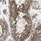 Choline Kinase Beta antibody, HPA018797, Atlas Antibodies, Immunohistochemistry paraffin image 