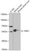 Telomeric Repeat Binding Factor 1 antibody, GTX32935, GeneTex, Western Blot image 