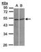 Glycine Receptor Alpha 3 antibody, GTX108513, GeneTex, Western Blot image 
