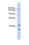 ATP Binding Cassette Subfamily C Member 8 antibody, NBP1-59778, Novus Biologicals, Western Blot image 