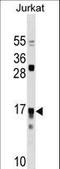 Interleukin 17 Receptor C antibody, LS-C159912, Lifespan Biosciences, Western Blot image 