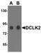 Serine/threonine-protein kinase DCLK2 antibody, NBP1-77128, Novus Biologicals, Western Blot image 