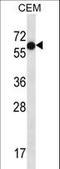 TFAP2B antibody, LS-C157170, Lifespan Biosciences, Western Blot image 