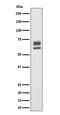 Protein Phosphatase 2 Regulatory Subunit B'Delta antibody, M06450-1, Boster Biological Technology, Western Blot image 