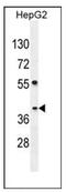 SEC13 Homolog, Nuclear Pore And COPII Coat Complex Component antibody, AP53829PU-N, Origene, Western Blot image 