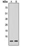 Procalcitonin antibody, orb235053, Biorbyt, Western Blot image 