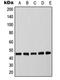 CCAAT Enhancer Binding Protein Alpha antibody, orb213722, Biorbyt, Western Blot image 