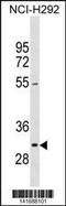 Nucleolar Protein Interacting With The FHA Domain Of MKI67 antibody, 60-769, ProSci, Western Blot image 