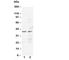 C-C Motif Chemokine Receptor 5 (Gene/Pseudogene) antibody, R30186, NSJ Bioreagents, Western Blot image 