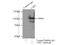 Ubiquitin Specific Peptidase 1 antibody, 14346-1-AP, Proteintech Group, Immunoprecipitation image 