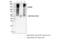 CD248 Molecule antibody, 47948S, Cell Signaling Technology, Immunoprecipitation image 