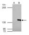 Histone Deacetylase 4 antibody, GTX110231, GeneTex, Immunoprecipitation image 