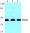 Galactokinase 1 antibody, PA5-75515, Invitrogen Antibodies, Western Blot image 
