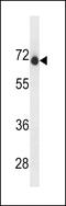 Endonuclease Domain Containing 1 antibody, 60-692, ProSci, Western Blot image 