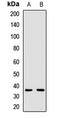 Spermatogenesis-associated protein 4 antibody, LS-C668969, Lifespan Biosciences, Western Blot image 